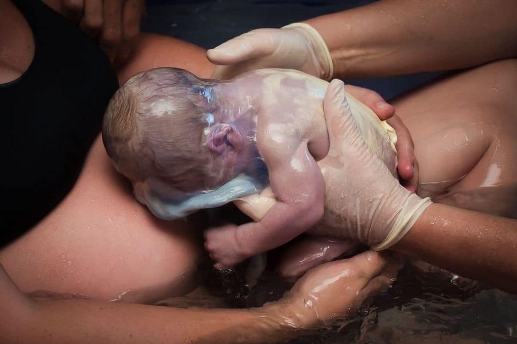 en Caul birth arizona